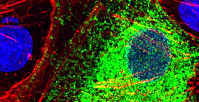 Una inteligencia artificial de Stanford aprendió a leer el idioma de las células y ya distingue sanas de enfermas